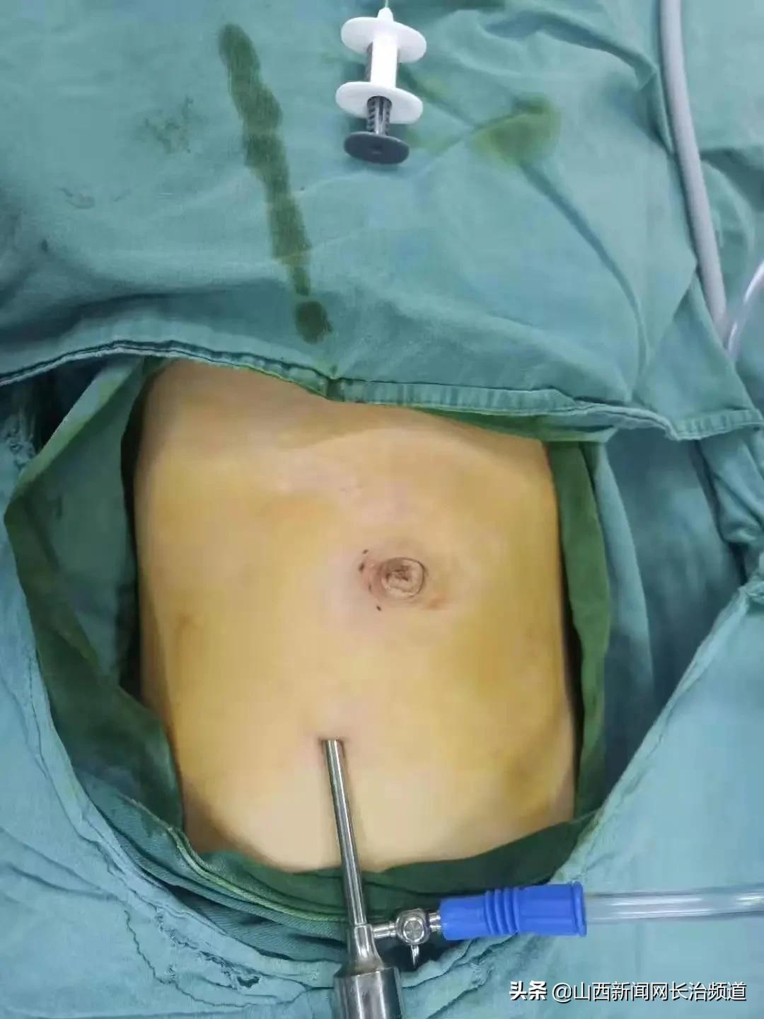 征兵體檢中的疤痕要求