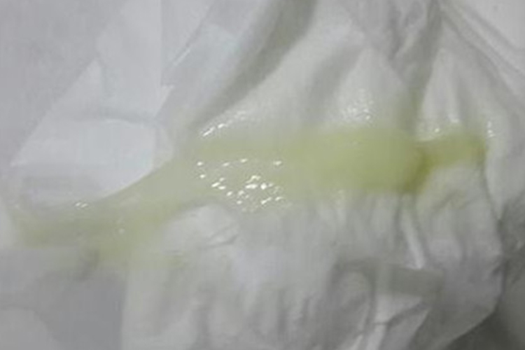 白帶黃綠色的原因及應對方法，了解你的身體狀況，白帶黃綠色原因解析與應對方法，關注你的身體健康