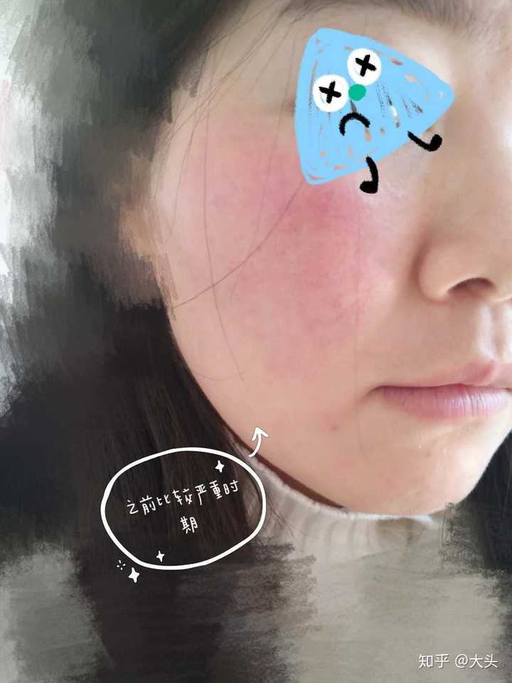 敏感肌膚修復(fù)指南，如何恢復(fù)健康正常肌膚，敏感肌膚修復(fù)全攻略，重塑健康肌膚的秘訣