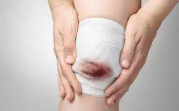 全面解析滑膜炎治療，如何根除病因，恢復(fù)健康，全面解析滑膜炎治療，根除病因，重塑健康之路