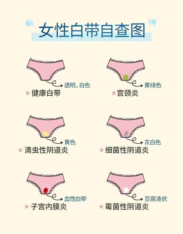 關(guān)于白帶，了解、關(guān)注與呵護(hù)女性健康的重要一環(huán)，女性健康的關(guān)鍵，了解、關(guān)注與呵護(hù)白帶的重要性