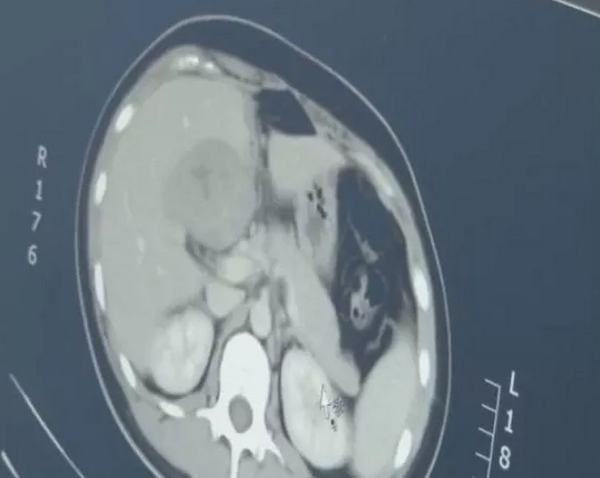 空孕囊的十個(gè)征兆，早期識(shí)別與應(yīng)對(duì)，空孕囊的十個(gè)征兆，早期識(shí)別與應(yīng)對(duì)策略