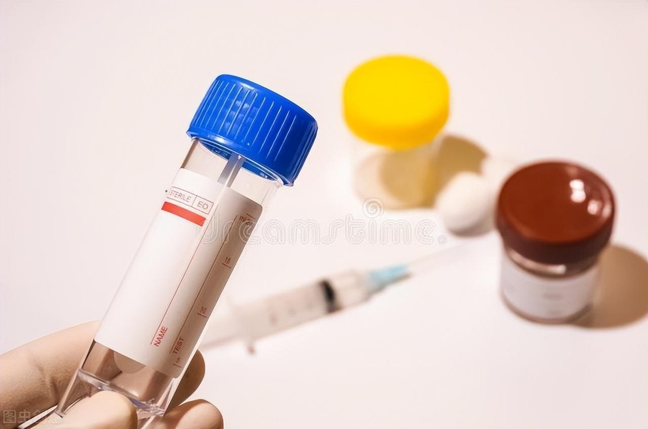 如何判斷是否得了痔瘡，痔瘡的判斷方法詳解