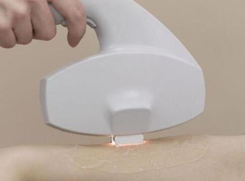 激光脫毛一次大概需要多少錢(qián)？詳解費(fèi)用因素與個(gè)人化差異，激光脫毛費(fèi)用詳解，價(jià)格因素與個(gè)人化差異探究