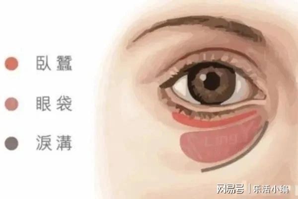 眼袋切除手術(shù)費用詳解，價格因素與如何選擇合適的手術(shù)方案，眼袋切除手術(shù)費用解析，了解價格因素與選擇最佳手術(shù)方案