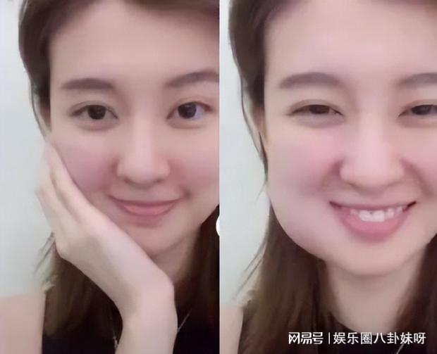 智齒被肉包住了一定要拔嗎？解讀智齒包埋現(xiàn)象及其處理方式，解讀智齒包埋現(xiàn)象，智齒被肉包住是否需要拔除？