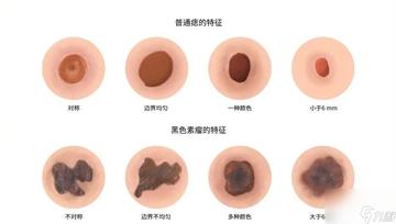 推薦 第20頁(yè)