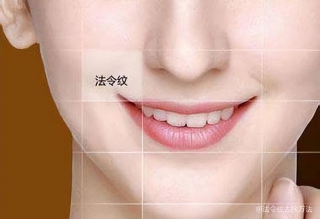 如何去除法令紋——打造青春無痕肌膚，如何消除法令紋，重塑青春無瑕肌膚